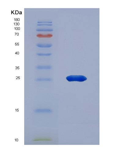 SDS-PAGE analysis of Human APOB (Apolipoprotein B-100) - Recombinant Protein, CATHuman APOB (Apolipoprotein B-100) - Recombinant Protein