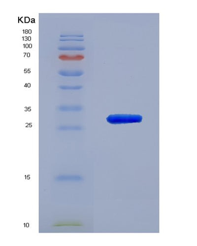 SDS-PAGE analysis of Human GZMA (Granzyme A) - Recombinant Protein, CAT# BLT-07678P, showing >90% purity under 15% SDS-PAGE (Reduced)Human GZMA (Granzyme A) - Recombinant Protein