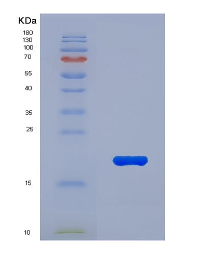 SDS-PAGE analysis of Human MUC5AC (Mucin-5Ac) - Recombinant Protein, CAT# BLT-07679P, showing >90% purity under 15% SDS-PAGE (Reduced)Human MUC5AC (Mucin-5Ac) - Recombinant Protein