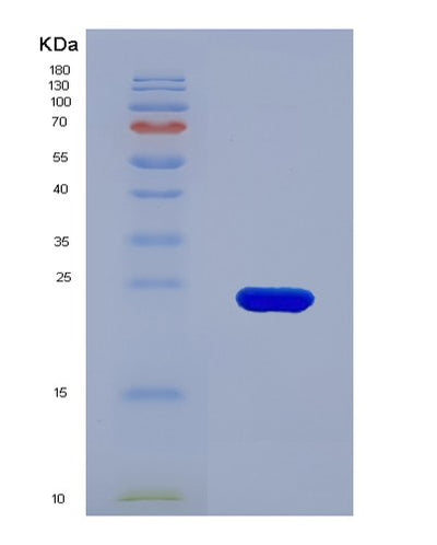 SDS-PAGE analysis of Human LCN2 (Neutrophil Gelatinase-Associated Lipocalin) - Recombinant Protein, CAT# BLT-01686P, showing >85% purity under 15% SDS-PAGE (Reduced)Human LCN2 (Neutrophil Gelatinase-Associated Lipocalin) - Recombinant Protein