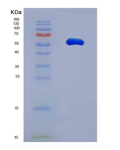 SDS-PAGE analysis of Human BASP1 (Brain Acid Soluble Protein 1) - Recombinant Protein, CAT# BLT-00285P, showing >95% purity under 15% SDS-PAGE (Reduced)Human BASP1 (Brain Acid Soluble Protein 1) - Recombinant Protein