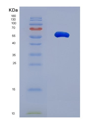 SDS-PAGE analysis of Human BASP1 (Brain Acid Soluble Protein 1) - Recombinant Protein, CATHuman BASP1 (Brain Acid Soluble Protein 1) - Recombinant Protein