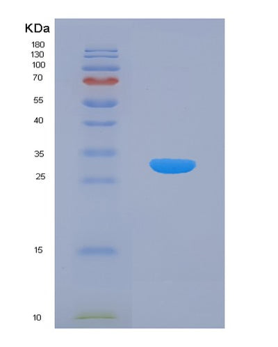 SDS-PAGE analysis of Human AHCYL1 (S-Adenosylhomocysteine Hydrolase-Like Protein 1) - Recombinant Protein, CAT# BLT-07680P, showing >90% purity under 15% SDS-PAGE (Reduced)Human AHCYL1 (S-Adenosylhomocysteine Hydrolase-Like Protein 1) - Recombinant Protein
