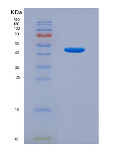 SDS-PAGE analysis of Human AHCYL2 (Adenosylhomocysteinase 3) - Recombinant Protein, CAT# BLT-07682P, showing >90% purity under 15% SDS-PAGE (Reduced)Human AHCYL2 (Adenosylhomocysteinase 3) - Recombinant Protein