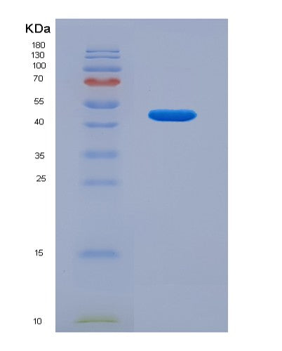 SDS-PAGE analysis of Human AHCYL2 (Adenosylhomocysteinase 3) - Recombinant Protein, CATHuman AHCYL2 (Adenosylhomocysteinase 3) - Recombinant Protein