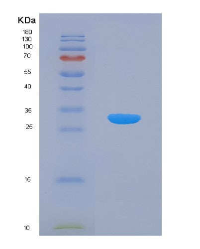 SDS-PAGE analysis of Human LEPR (Leptin Receptor) - Recombinant Protein, CATHuman LEPR (Leptin Receptor) - Recombinant Protein