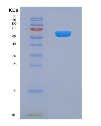 SDS-PAGE analysis of Human WNT5B (Protein Wnt-5B) - Recombinant Protein, CAT# BLT-07689P, showing >90% purity under 15% SDS-PAGE (Reduced)Human WNT5B (Protein Wnt-5B) - Recombinant Protein