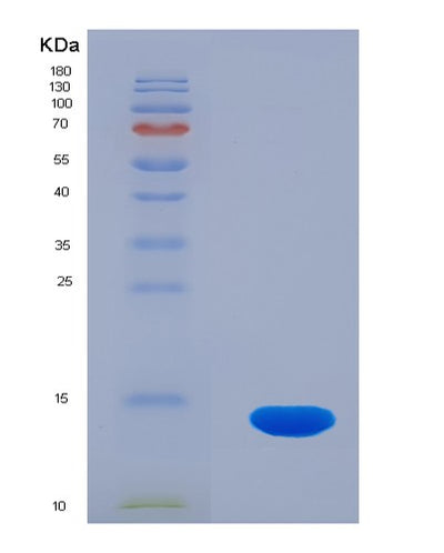 SDS-PAGE analysis of Human PLOD3 (Multifunctional Procollagen Lysine Hydroxylase And Glycosyltransferase Lh3) - Recombinant Protein, CAT# BLT-07692P, showing >90% purity under 15% SDS-PAGE (Reduced)Human PLOD3 (Multifunctional Procollagen Lysine Hydroxylase And Glycosyltransferase Lh3) - Recombinant Protein