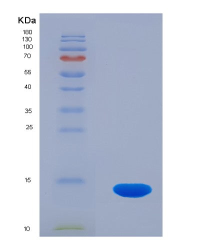 SDS-PAGE analysis of Human PLOD3 (Multifunctional Procollagen Lysine Hydroxylase And Glycosyltransferase Lh3) - Recombinant Protein, CATHuman PLOD3 (Multifunctional Procollagen Lysine Hydroxylase And Glycosyltransferase Lh3) - Recombinant Protein