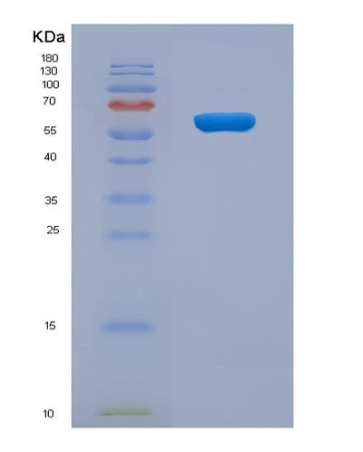 SDS-PAGE analysis of Human XIAP (E3 Ubiquitin-Protein Ligase Xiap) - Recombinant Protein, CAT# BLT-06527P, showing >90% purity under 15% SDS-PAGE (Reduced)Human XIAP (E3 Ubiquitin-Protein Ligase Xiap) - Recombinant Protein