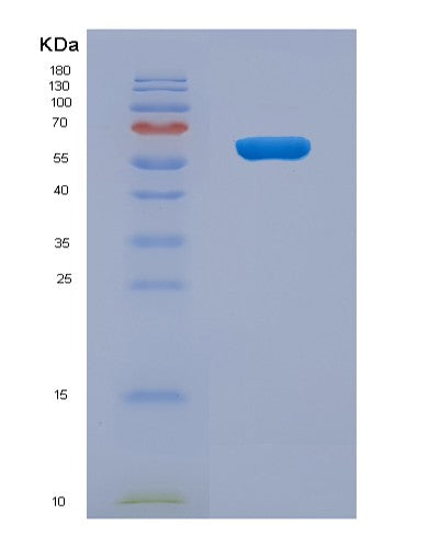 SDS-PAGE analysis of Human XIAP (E3 Ubiquitin-Protein Ligase Xiap) - Recombinant Protein, CATHuman XIAP (E3 Ubiquitin-Protein Ligase Xiap) - Recombinant Protein