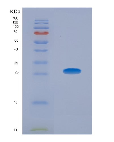 SDS-PAGE analysis of Human CDK5 (Cyclin-Dependent Kinase 5) - Recombinant Protein, CATHuman CDK5 (Cyclin-Dependent Kinase 5) - Recombinant Protein