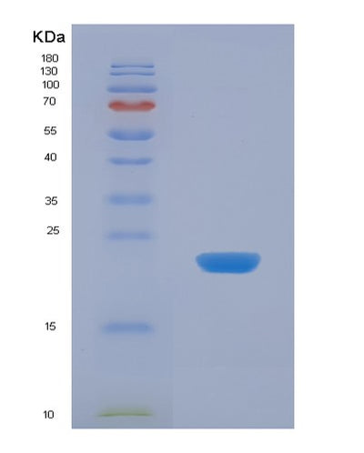 SDS-PAGE analysis of Human APOD (Apolipoprotein D) - Recombinant Protein, CAT# BLT-07695P, showing >90% purity under 15% SDS-PAGE (Reduced)Human APOD (Apolipoprotein D) - Recombinant Protein