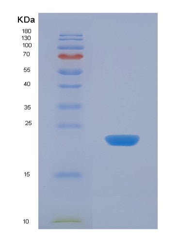 SDS-PAGE analysis of Human APOD (Apolipoprotein D) - Recombinant Protein, CATHuman APOD (Apolipoprotein D) - Recombinant Protein
