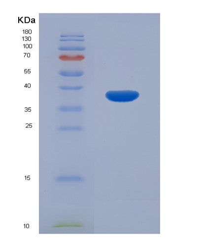 SDS-PAGE analysis of Mouse Mt1 (Metallothionein-1) - Recombinant Protein, CATMouse Mt1 (Metallothionein-1) - Recombinant Protein