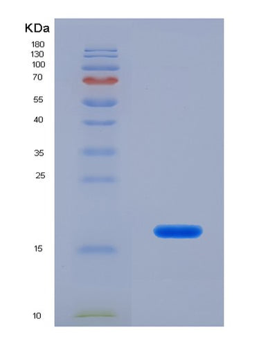 SDS-PAGE analysis of Human MYL7 (Myosin Regulatory Light Chain 2, Atrial Isoform) - Recombinant Protein, CAT# BLT-01942P, showing >85% purity under 15% SDS-PAGE (Reduced)Human MYL7 (Myosin Regulatory Light Chain 2, Atrial Isoform) - Recombinant Protein