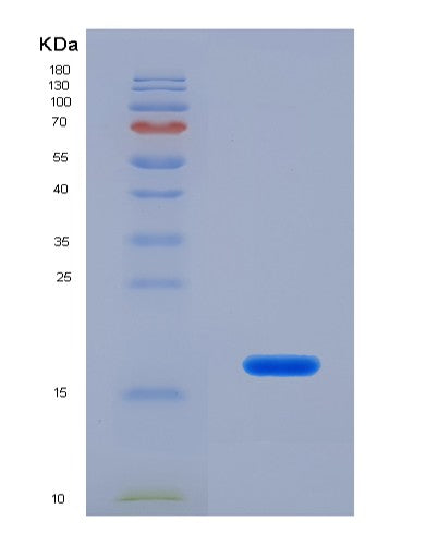 SDS-PAGE analysis of Human MYL7 (Myosin Regulatory Light Chain 2, Atrial Isoform) - Recombinant Protein, CATHuman MYL7 (Myosin Regulatory Light Chain 2, Atrial Isoform) - Recombinant Protein