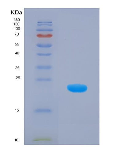 SDS-PAGE analysis of Human HMGCS1 (Hydroxymethylglutaryl-Coa Synthase, Cytoplasmic) - Recombinant Protein, CAT# BLT-01390P, showing >85% purity under 15% SDS-PAGE (Reduced)Human HMGCS1 (Hydroxymethylglutaryl-Coa Synthase, Cytoplasmic) - Recombinant Protein