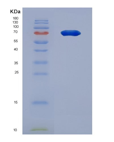 SDS-PAGE analysis of Human HGD (Homogentisate 1,2-Dioxygenase) - Recombinant Protein, CATHuman HGD (Homogentisate 1,2-Dioxygenase) - Recombinant Protein