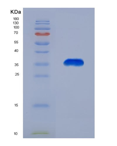 SDS-PAGE analysis of Human CREBBP (Creb-Binding Protein) - Recombinant Protein, CAT# BLT-07699P, showing >90% purity under 15% SDS-PAGE (Reduced)Human CREBBP (Creb-Binding Protein) - Recombinant Protein