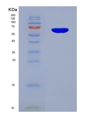SDS-PAGE analysis of Human PRF1 (Perforin-1) - Recombinant Protein, CAT# BLT-07701P, showing >90% purity under 15% SDS-PAGE (Reduced)Human PRF1 (Perforin-1) - Recombinant Protein