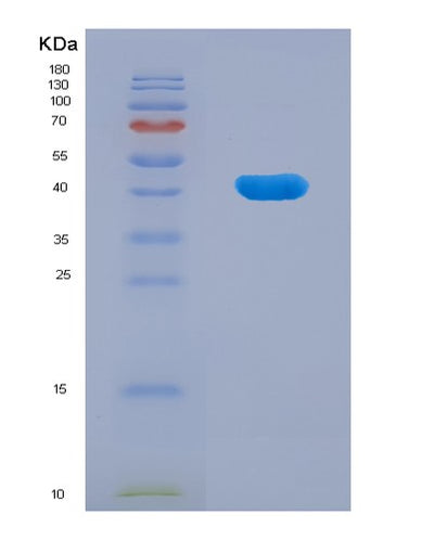 SDS-PAGE analysis of Human FANCD2 (Fanconi Anemia Group D2 Protein) - Recombinant Protein, CAT# BLT-07702P, showing >90% purity under 15% SDS-PAGE (Reduced)Human FANCD2 (Fanconi Anemia Group D2 Protein) - Recombinant Protein