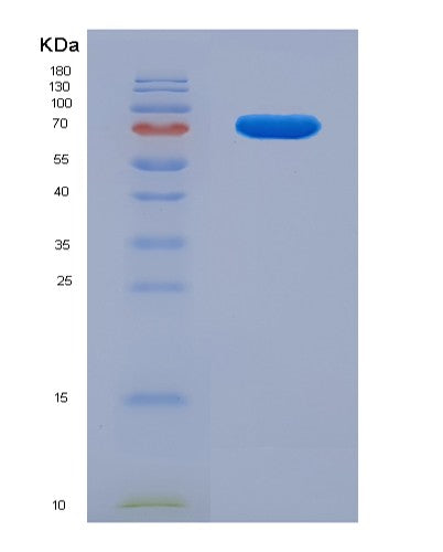 SDS-PAGE analysis of Human FKBP4 (Peptidyl-Prolyl Cis-Trans Isomerase Fkbp4) - Recombinant Protein, CATHuman FKBP4 (Peptidyl-Prolyl Cis-Trans Isomerase Fkbp4) - Recombinant Protein