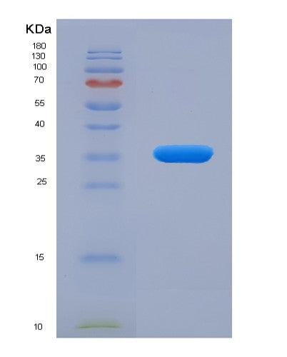 SDS-PAGE analysis of Human RELA (Transcription Factor P65) - Recombinant Protein, CATHuman RELA (Transcription Factor P65) - Recombinant Protein