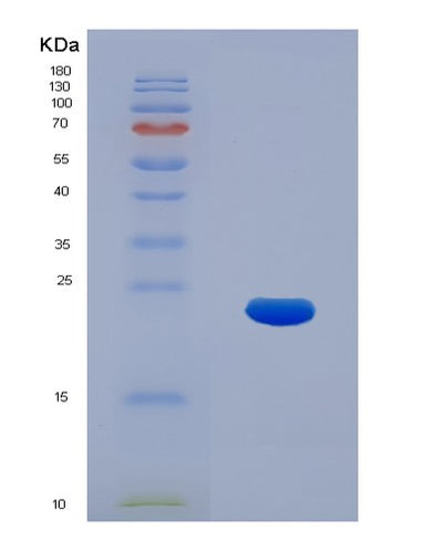 SDS-PAGE analysis of Human KRT17 (Keratin, Type I Cytoskeletal 17) - Recombinant Protein, CAT# BLT-01663P, showing >95% purity under 15% SDS-PAGE (Reduced)Human KRT17 (Keratin, Type I Cytoskeletal 17) - Recombinant Protein