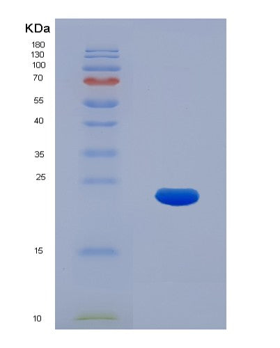 SDS-PAGE analysis of Human KRT17 (Keratin, Type I Cytoskeletal 17) - Recombinant Protein, CATHuman KRT17 (Keratin, Type I Cytoskeletal 17) - Recombinant Protein