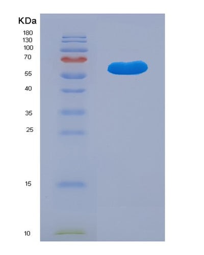 SDS-PAGE analysis of Human KDSR (3-Ketodihydrosphingosine Reductase) - Recombinant Protein, CAT# BLT-01620P, showing >90% purity under 15% SDS-PAGE (Reduced)Human KDSR (3-Ketodihydrosphingosine Reductase) - Recombinant Protein
