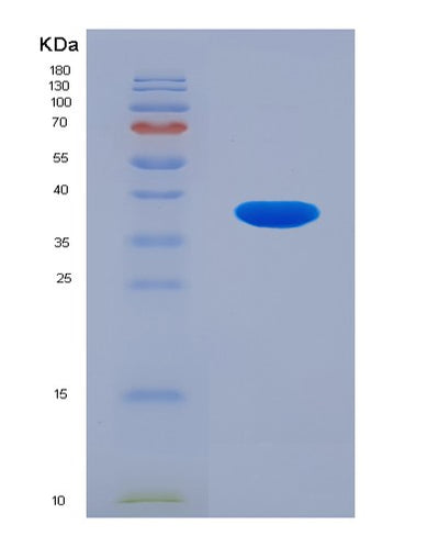 SDS-PAGE analysis of Human GFPT1 (Glutamine--Fructose-6-Phosphate Aminotransferase [Isomerizing] 1) - Recombinant Protein, CAT# BLT-01188P, showing >85% purity under 15% SDS-PAGE (Reduced)Human GFPT1 (Glutamine--Fructose-6-Phosphate Aminotransferase [Isomerizing] 1) - Recombinant Protein