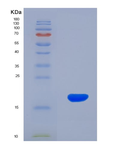 SDS-PAGE analysis of Human GP6 (Platelet Glycoprotein Vi) - Recombinant Protein, CAT# BLT-07703P, showing >90% purity under 15% SDS-PAGE (Reduced)Human GP6 (Platelet Glycoprotein Vi) - Recombinant Protein