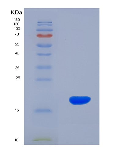 SDS-PAGE analysis of Human GP6 (Platelet Glycoprotein Vi) - Recombinant Protein, CATHuman GP6 (Platelet Glycoprotein Vi) - Recombinant Protein