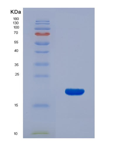 SDS-PAGE analysis of Human CXCL9 (C-X-C Motif Chemokine 9) - Recombinant Protein, CAT# BLT-00780P, showing >85% purity under 15% SDS-PAGE (Reduced)Human CXCL9 (C-X-C Motif Chemokine 9) - Recombinant Protein