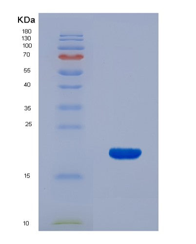 SDS-PAGE analysis of Human CXCL9 (C-X-C Motif Chemokine 9) - Recombinant Protein, CATHuman CXCL9 (C-X-C Motif Chemokine 9) - Recombinant Protein
