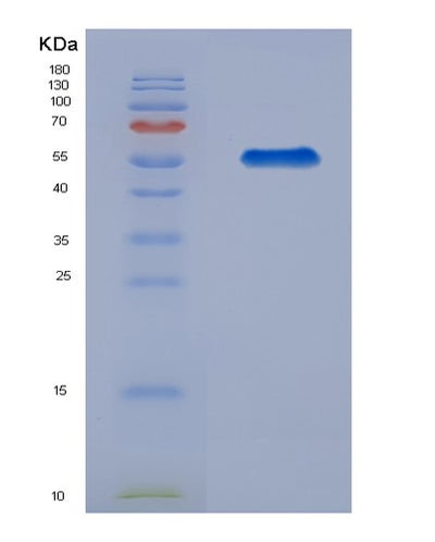 SDS-PAGE analysis of Human RGS1 (Regulator Of G-Protein Signaling 1) - Recombinant Protein, CAT# BLT-02568P, showing >85% purity under 15% SDS-PAGE (Reduced)Human RGS1 (Regulator Of G-Protein Signaling 1) - Recombinant Protein