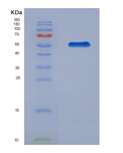 SDS-PAGE analysis of Human RGS1 (Regulator Of G-Protein Signaling 1) - Recombinant Protein, CATHuman RGS1 (Regulator Of G-Protein Signaling 1) - Recombinant Protein
