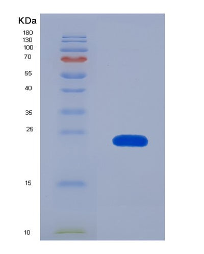 SDS-PAGE analysis of Human NOG (Noggin) - Recombinant Protein, CAT# BLT-07704P, showing >90% purity under 15% SDS-PAGE (Reduced)Human NOG (Noggin) - Recombinant Protein