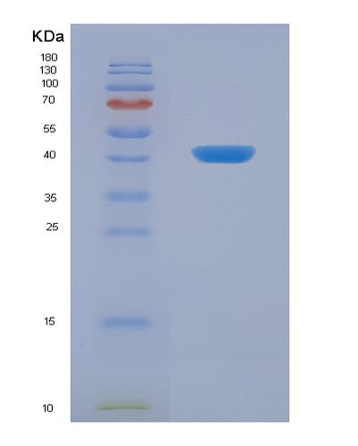 SDS-PAGE analysis of Human SYCN (Syncollin) - Recombinant Protein, CAT# BLT-07137P, showing >90% purity under 15% SDS-PAGE (Reduced)Human SYCN (Syncollin) - Recombinant Protein