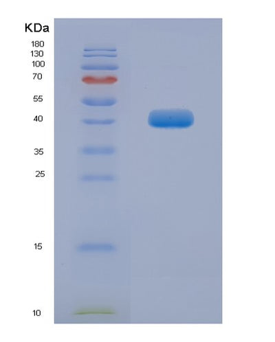 SDS-PAGE analysis of Human TEF (Thyrotroph Embryonic Factor) - Recombinant Protein, CAT# BLT-03007P, showing >95% purity under 15% SDS-PAGE (Reduced)Human TEF (Thyrotroph Embryonic Factor) - Recombinant Protein