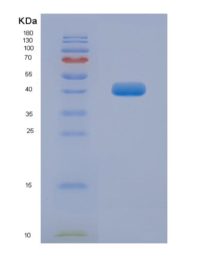 SDS-PAGE analysis of Human TEF (Thyrotroph Embryonic Factor) - Recombinant Protein, CATHuman TEF (Thyrotroph Embryonic Factor) - Recombinant Protein