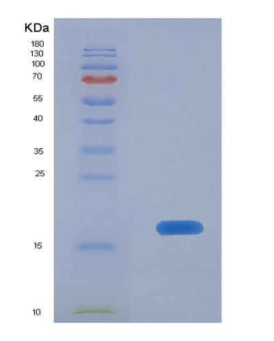 SDS-PAGE analysis of Human BST2 (Bone Marrow Stromal Antigen 2) - Recombinant Protein, CAT# BLT-00359P, showing >90% purity under 15% SDS-PAGE (Reduced)Human BST2 (Bone Marrow Stromal Antigen 2) - Recombinant Protein