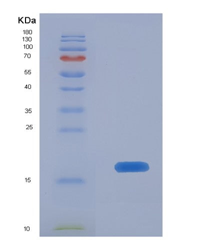 SDS-PAGE analysis of Human BST2 (Bone Marrow Stromal Antigen 2) - Recombinant Protein, CATHuman BST2 (Bone Marrow Stromal Antigen 2) - Recombinant Protein