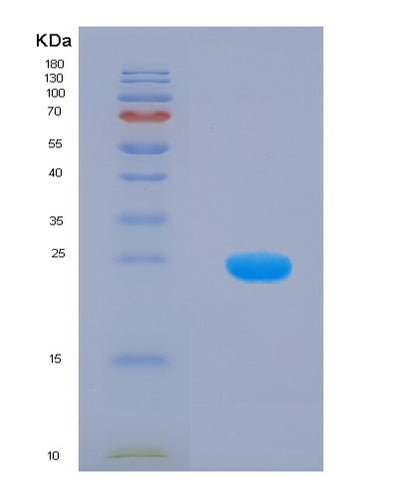 SDS-PAGE analysis of Human CETN1 (Centrin-1) - Recombinant Protein, CAT# BLT-00568P, showing >90% purity under 15% SDS-PAGE (Reduced)Human CETN1 (Centrin-1) - Recombinant Protein