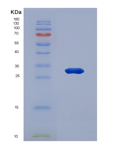 SDS-PAGE analysis of Human ADCY2 (Adenylate Cyclase Type 2) - Recombinant Protein, CATHuman ADCY2 (Adenylate Cyclase Type 2) - Recombinant Protein