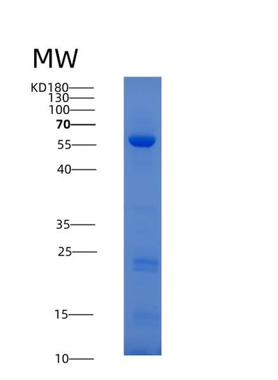 SDS-PAGE analysis of Human GMDS (Gdp-Mannose 4,6 Dehydratase) - Recombinant Protein, CAT# BLT-01225P, showing >90% purity under 15% SDS-PAGE (Reduced)Human GMDS (Gdp-Mannose 4,6 Dehydratase) - Recombinant Protein