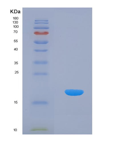 SDS-PAGE analysis of Human AIMP1 (Aminoacyl Trna Synthase Complex-Interacting Multifunctional Protein 1) - Recombinant Protein, CAT# BLT-00094P, showing >85% purity under 15% SDS-PAGE (Reduced)Human AIMP1 (Aminoacyl Trna Synthase Complex-Interacting Multifunctional Protein 1) - Recombinant Protein