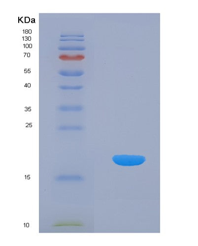 SDS-PAGE analysis of Human AIMP1 (Aminoacyl Trna Synthase Complex-Interacting Multifunctional Protein 1) - Recombinant Protein, CATHuman AIMP1 (Aminoacyl Trna Synthase Complex-Interacting Multifunctional Protein 1) - Recombinant Protein