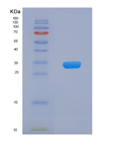 SDS-PAGE analysis of Human LMAN2 (Vesicular Integral-Membrane Protein Vip36) - Recombinant Protein, CAT# BLT-05393P, showing >90% purity under 15% SDS-PAGE (Reduced)Human LMAN2 (Vesicular Integral-Membrane Protein Vip36) - Recombinant Protein